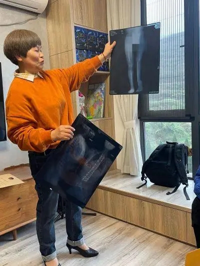 图为陈露园的妈妈手持女儿布满钢钉的X光片